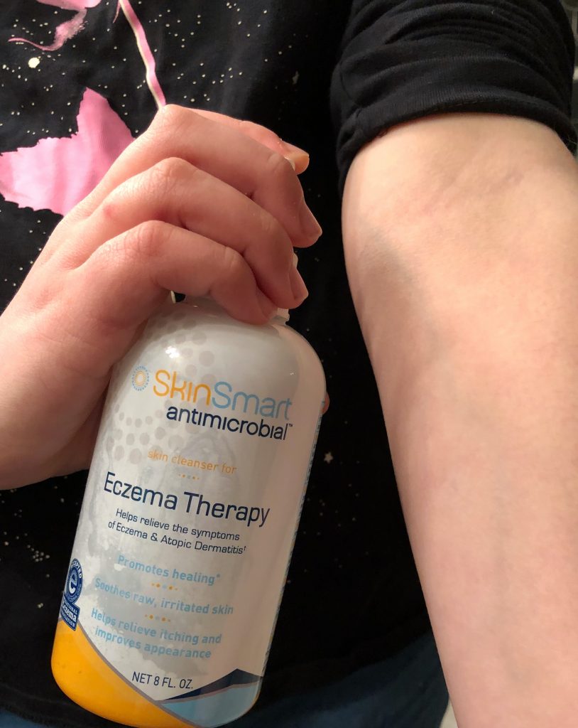 Eczema Relief with SkinSmart Microbial Spray